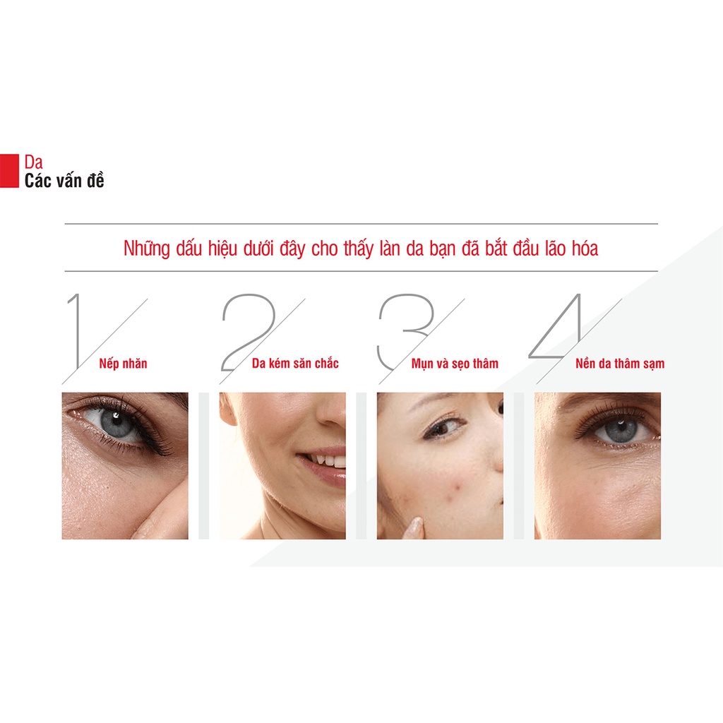 Máy nâng cơ và tái tạo da chuyên sâu Lifetrons RF700 xoá rãnh cười, nếp nhăn