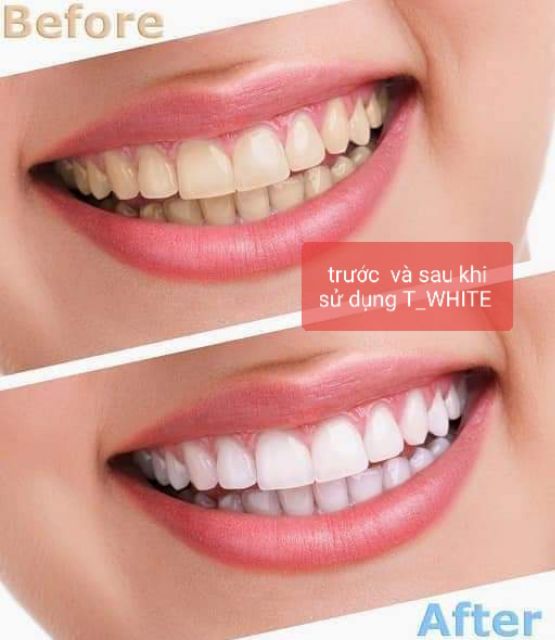 Bột trắng răng T - White