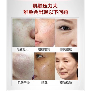 Tinh chất dưỡng da Meiking HA essence