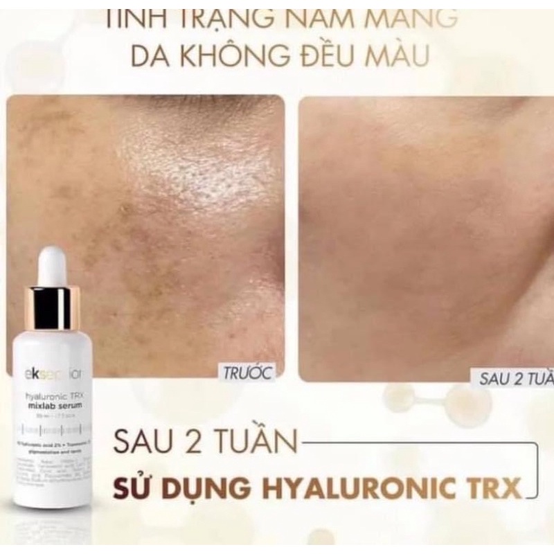 Tinh chất HYALURONIC TRX ekseption - CẢI THIỆN SẮC TỐ DA SAU 10 NGÀY