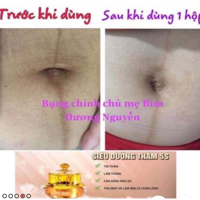 BIHO_LADI SIÊU DƯỠNG THÂM 5S ĐÁNH BAY THÂM NÁCH, BIKINI, MÔNG