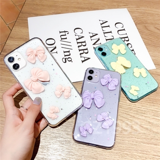 Ốp điện thoại trong suốt thời trang cho oppo a92s a92 a52 a91 a31 reno reno 4 reno 3 reno 2f reno 2 a9 2020 a5 2020 f11 a7 a5s a12 a3s f9 r17 r15