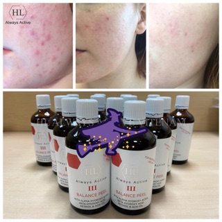 Thay da hoá học peel HL III