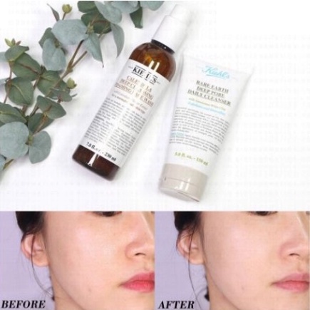 Kiehl's Rare Earth Deep Pore Daily Cleanser - Sữa Rửa Mặt Đất Sét Cho Da Dầu 150ml