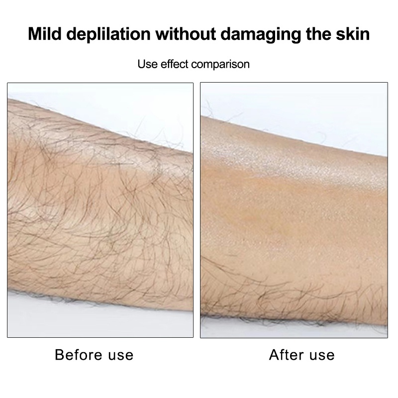 Dụng cụ tẩy lông Suake bằng sợi nano không đau có thể tái sử dụng