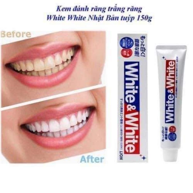 Kem đánh răng trắng răng White &amp; White 150g Nhật Bản chính hãng