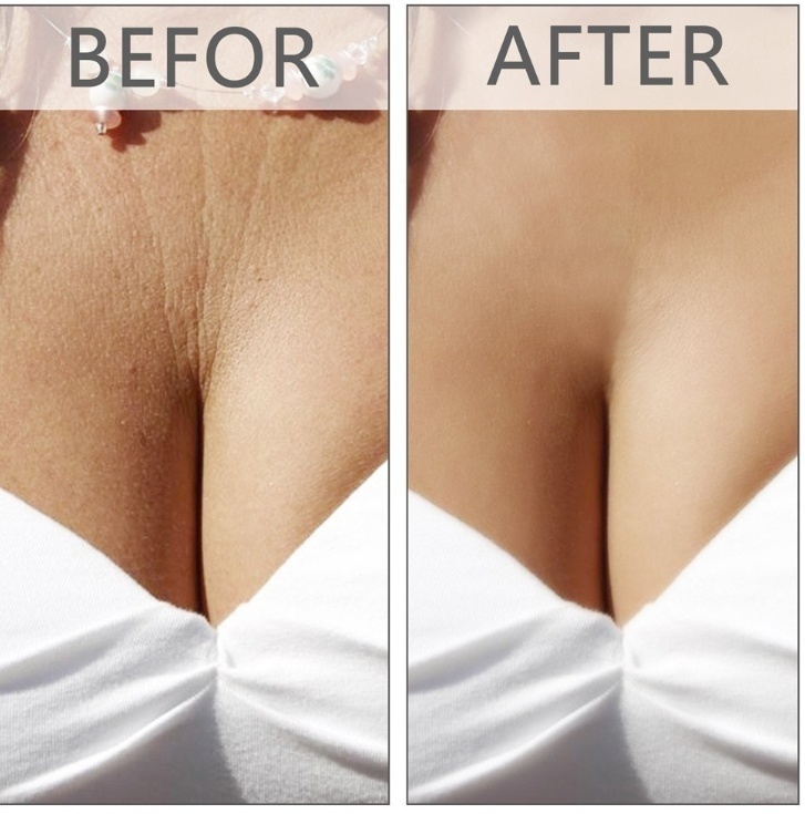 Kem dưỡng da mặt và cổ chống nếp nhăn chứa Peptide | BigBuy360 - bigbuy360.vn