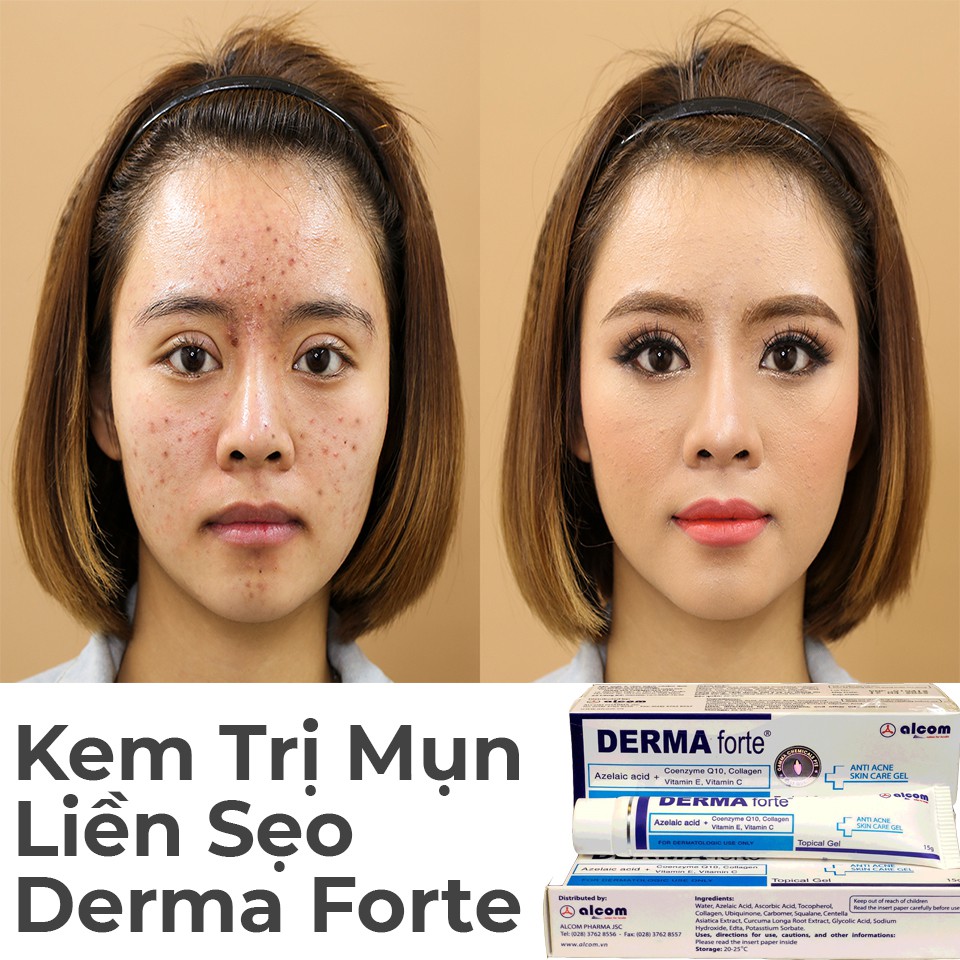 Derma Forte 15g - Gam Ma, Gel Giúp Giảm Mụn Trứng Cá, Ngừa Thâm, Mờ Sẹo, Dưỡng Da