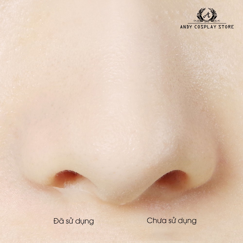 [CÓ SẴN] Miếng dán thu gọn mũi Assist Wig