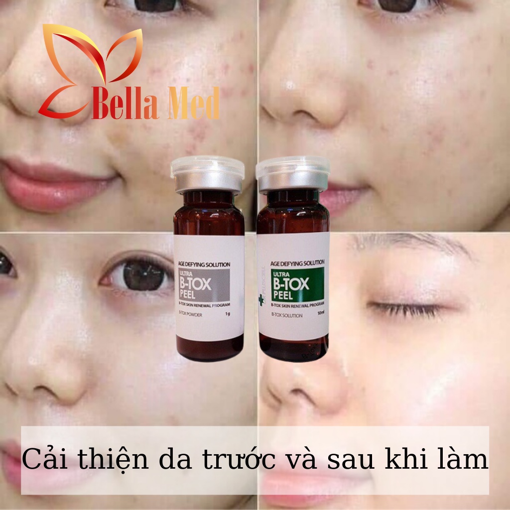 Thay da sinh học BTOX PEEL 2 màu Skin Renewal System