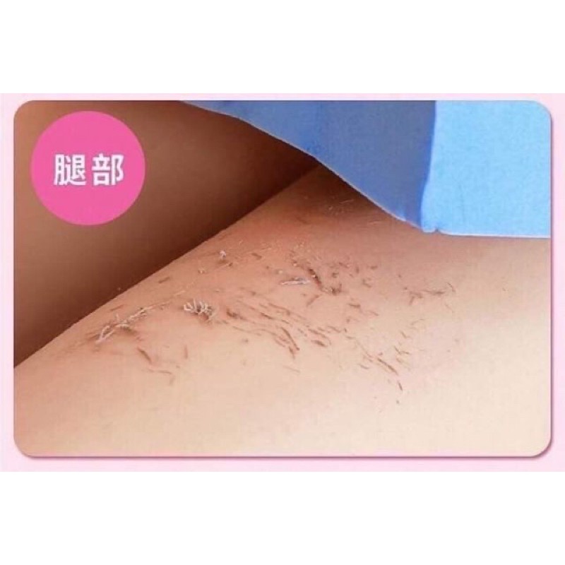 miếng kì ghét thần thánh