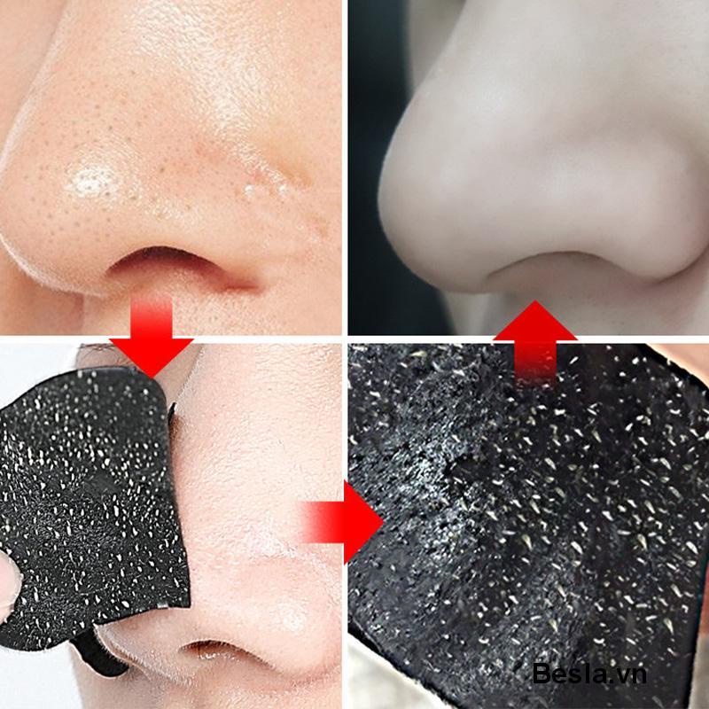 🌈Miếng dán lột mụn  làm sạch sâu hỗ trợ giảm mụn đầu đen cho vùng mũi  miếng