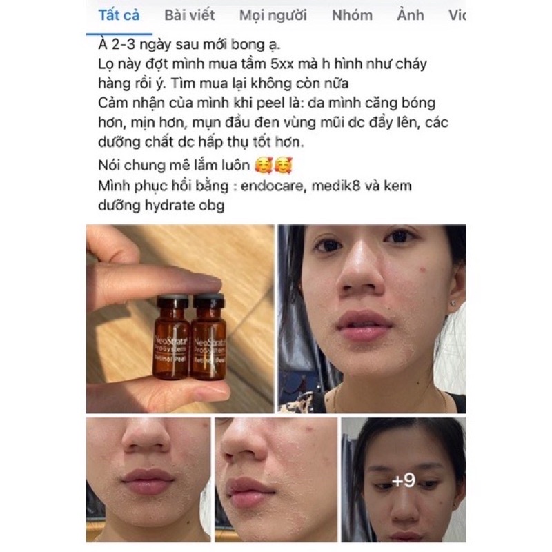 Thay Da Sinh Học Peel Retinol Neostrata Ống 1.5ml