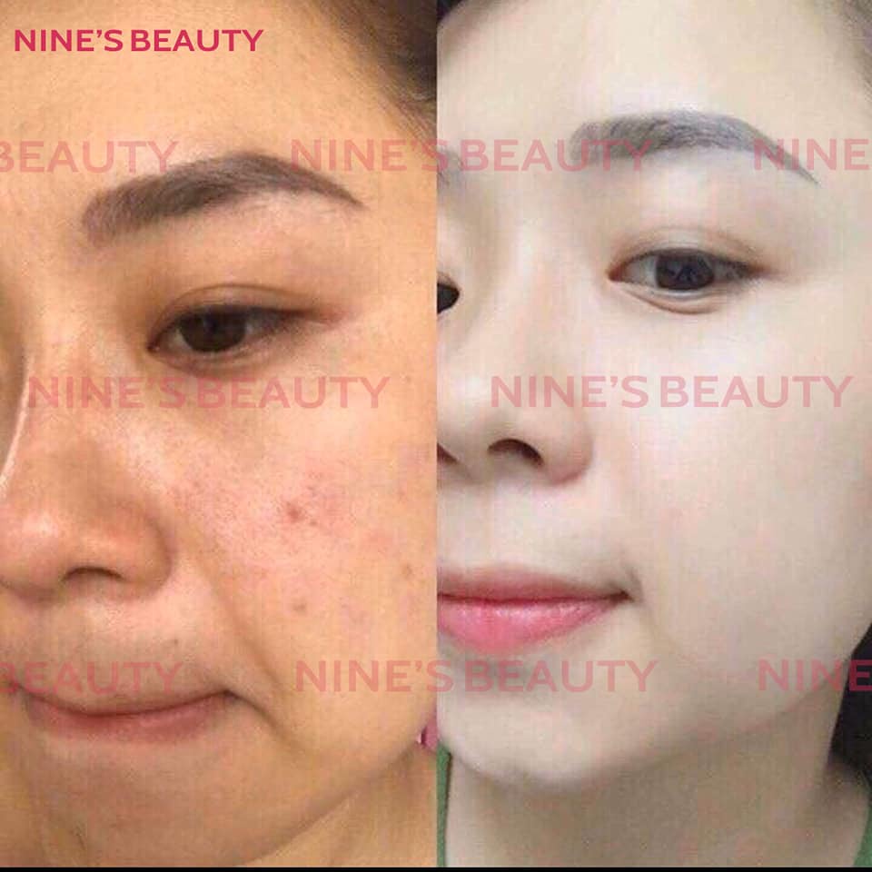 Viên Uống Trắng Da, Mờ Nám, Giảm Nếp Nhăn NiNe's Beauty