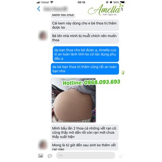 Kem ngừa rạn da Amella