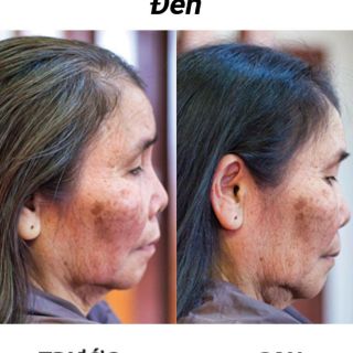 TINH BỘT LÁ NHUỘM TÓC THẢO DƯỢC