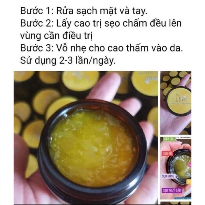 Cao sẹo collagen 30g giá sỉ tận xưởng