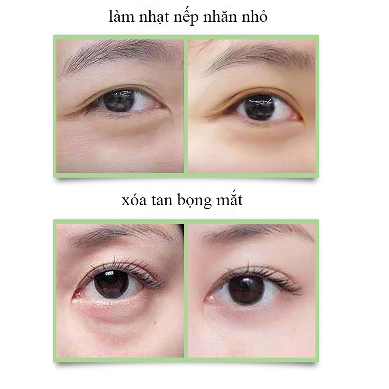 Kem dưỡng mắt xóa quầng thâm mắt massage vùng mắt dưỡng ẩm da mềm mịn 30g | BigBuy360 - bigbuy360.vn