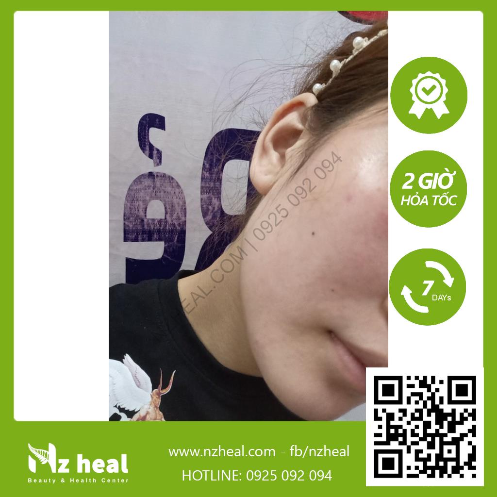 Kem Mật Ong 16+ Manuka Skin Health Madeleine Ritchie 80ml