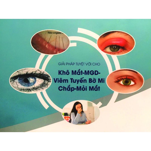 BĂNG CHE MẮT CHƯỜM ẤM EYEGIENE