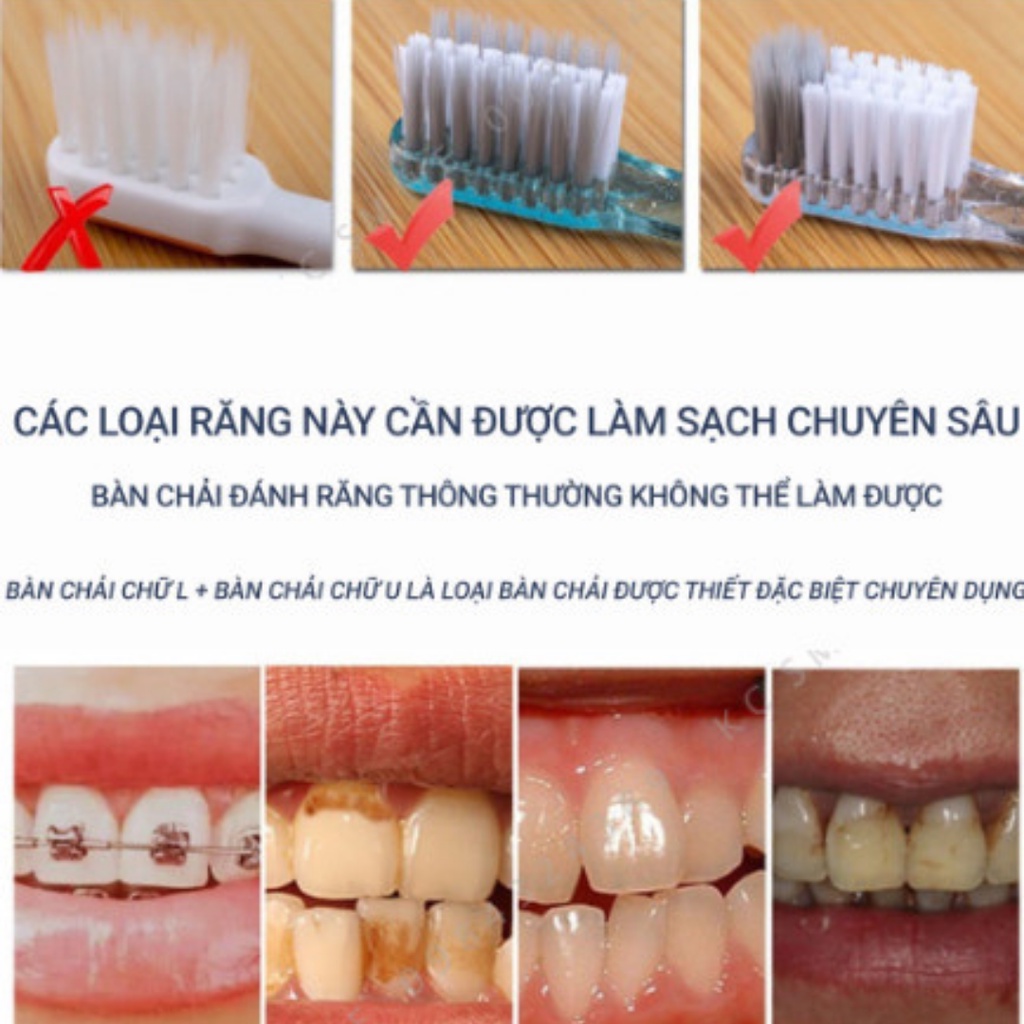 Bàn chải đánh răng cho người niềng răng làm sạch sâu sáng tối, tặng kèm bàn chải kẽ chữ I và bàn chải kẽ chữ L