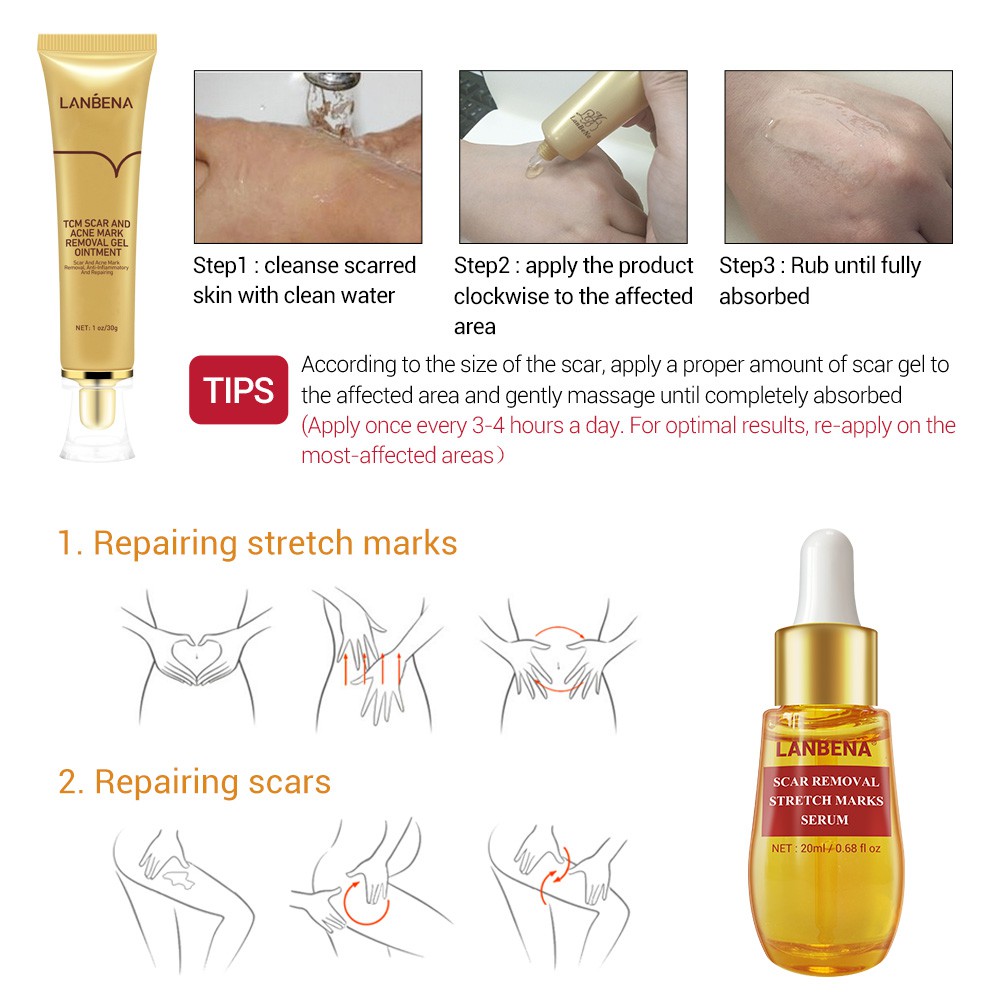 Set 2 Mỹ Phẩm Chăm Sóc Da LANBENA Gồm Serum Xóa Sẹo Mụn+Kem Làm Trắng Mụn Đầu Đen Thu Nhỏ Lỗ Chân Lông Làm Mờ Vết Rạn Da | BigBuy360 - bigbuy360.vn