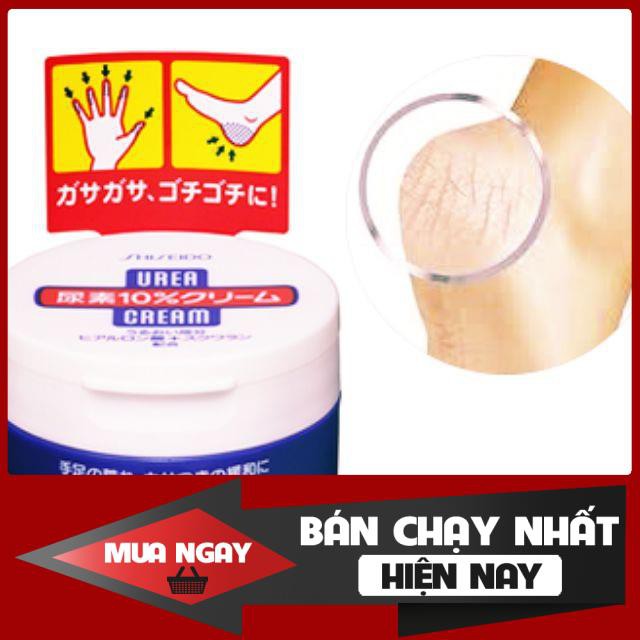 Kem trị nứt gót chân Shiseido Urea Cream