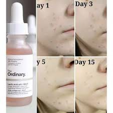 tẩy da chết hoá học AHA Lactic Acid 5% 10% + HA 2% THE ORDINARY 30ml