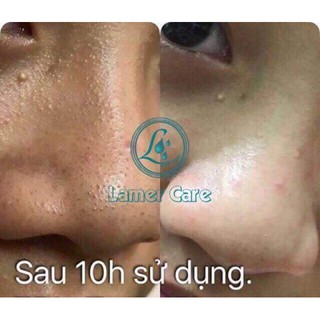 toner tinh thể bạc hà lamer