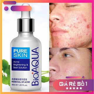 SERUM MỤN TRẮNG DA BIOAQUA DƯỠNG ẨM CẤP TỐC 
