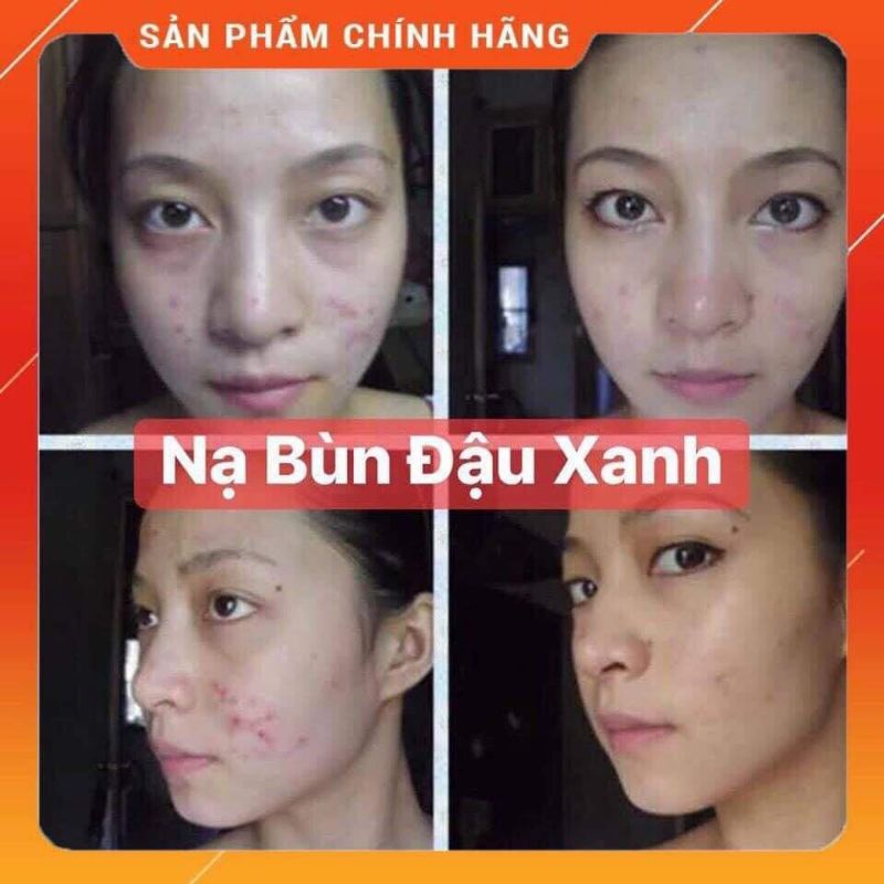 mặt nạ bùn đậu xanh