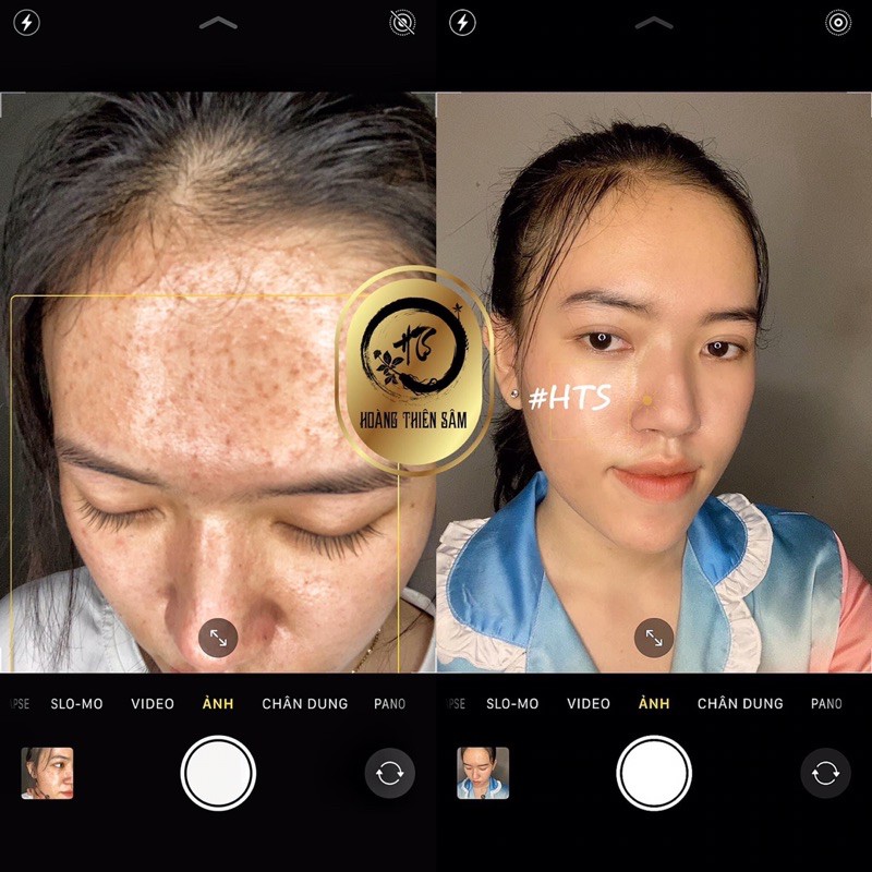 (tăng cao hút mụn) Hoàng Thiên Sâm VIP ⚡️Freeship ⚡️tái tạo nhẹ tênh với phiên bản VIP | BigBuy360 - bigbuy360.vn