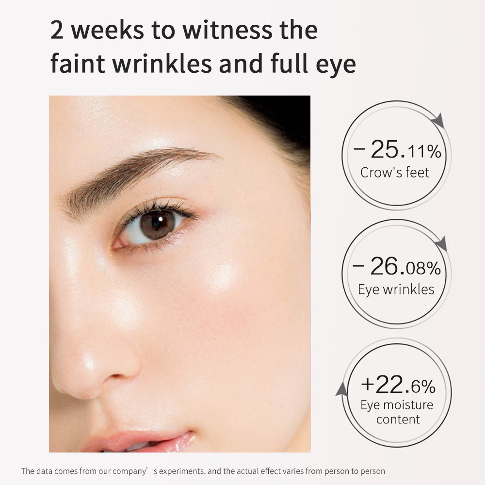 Kem dưỡng da quanh mắt SKIN EVER giảm quầng thâm/ nếp nhăn hiệu quả 20g | BigBuy360 - bigbuy360.vn