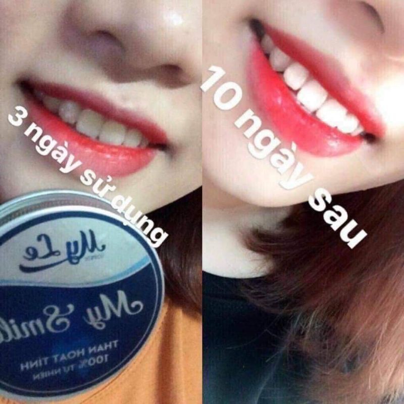 (TẶNG BÀN CHẢI )TẨY TRẮNG RĂNG, THAN HOẠT TÍNH TRẮNG RĂNG MYSMILE