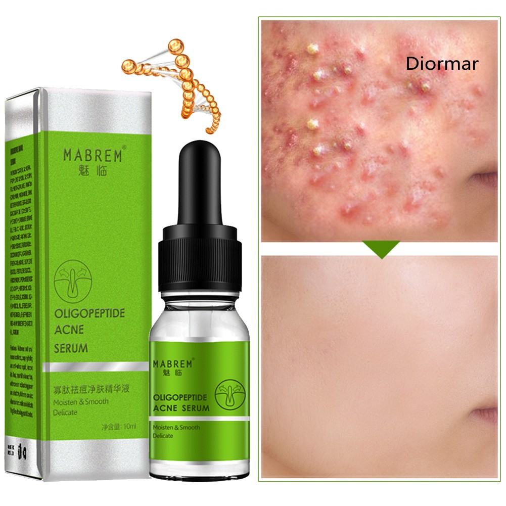 (Hàng Mới Về) Serum Trị Mụn Dưỡng Ẩm Kiểm Soát Dầu Dio Oliopeptide