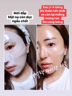 Mặt nạ Derm-all Maxtric ADVANCED SKIN CARE SYSTEM