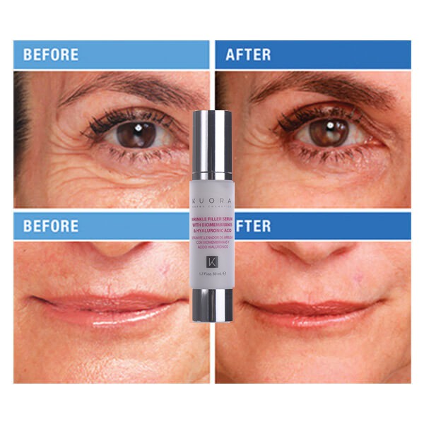 Serum Dưỡng Ẩm Cho Da Khô -Giúp Da Căng Bóng, Xóa Mờ Nếp Nhăn, Tăng Độ Ẩm, & Trẻ Hóa Da - Dược Mỹ Phẩm Cao Cấp Châu Âu | BigBuy360 - bigbuy360.vn