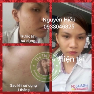 KEM NGHỆ NẾP ĐỎ