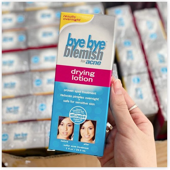 Kem Mụn Bye Bye Blemish Drying Lotion
