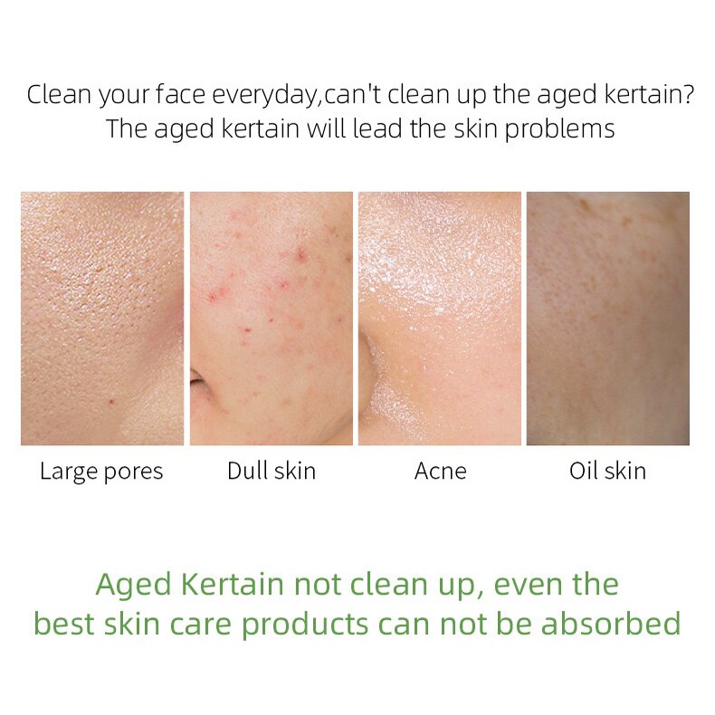 Gel Trà Xanh LAIKOU 60ml Tẩy Tế Bào Chết Dưỡng Ẩm Làm Trắng Da