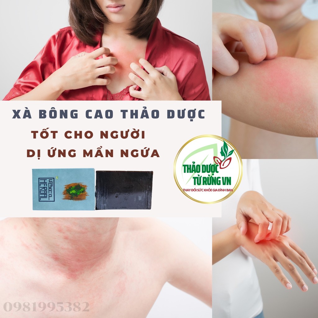 [TẶNG TÚI LƯỚI] Xà Phòng - Xà Bông Handmade Cao Thảo Dược HERBAL Mát Da - Xà Bông Ngừa Mụn Lưng 100g