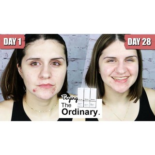 Tinh chất giảm mụn the ordinary salicylic acid 2% solution 30ml
