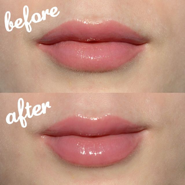 - Son Dưỡng Sephora Collection Lip Balm