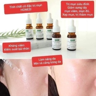 Honesi trị mụn chai lẻ 10ml