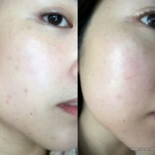 Nước hoa hồng Toner Dickinson's