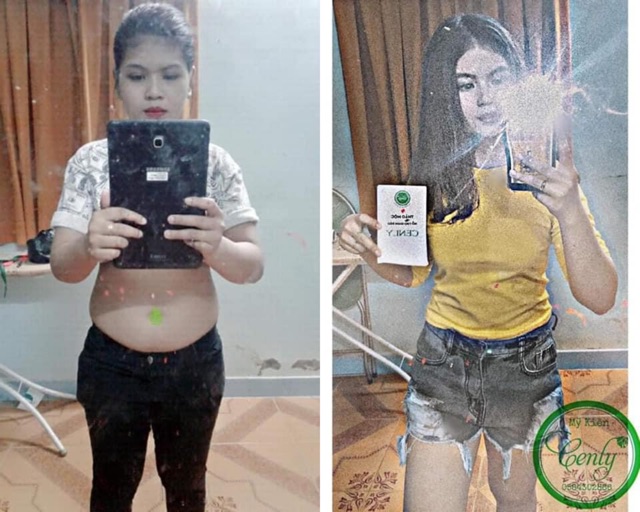 Giảm béo Cenly 💚 Chính Hãng [ Giảm cân an toàn k tác dụng phụ] | BigBuy360 - bigbuy360.vn