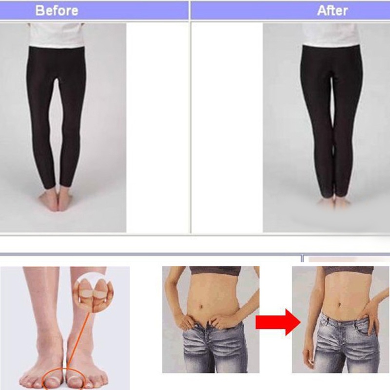 2 Nhẫn Silicone Có Nam Châm Đeo Ngón Chân Tiện Lợi