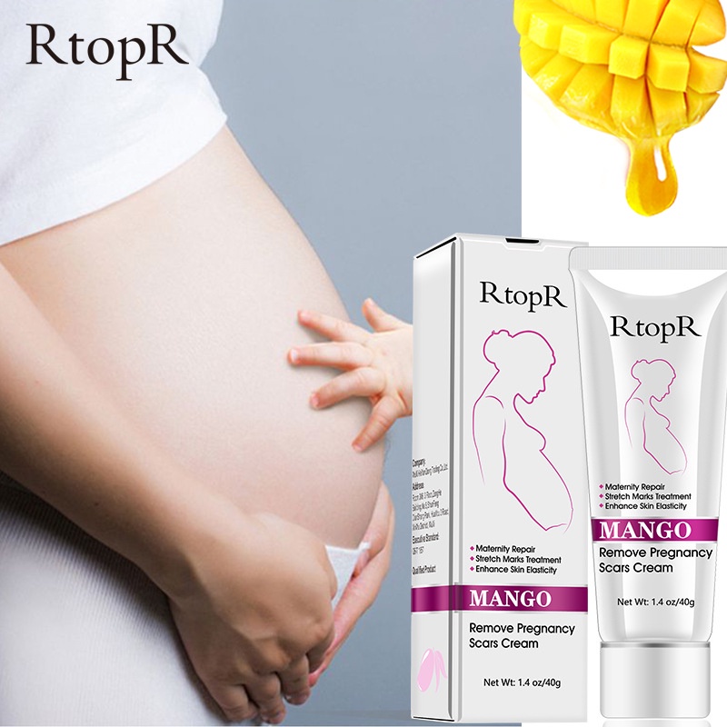 Kem Làm Mờ Rạn Da, Xóa Sẹo Sau Sinh/Rạn Do Tăng Cân Cấp Ẩm Phục Hồi Tái Tạo Da RtopR Mango Remove Pregnancy Scars Cream