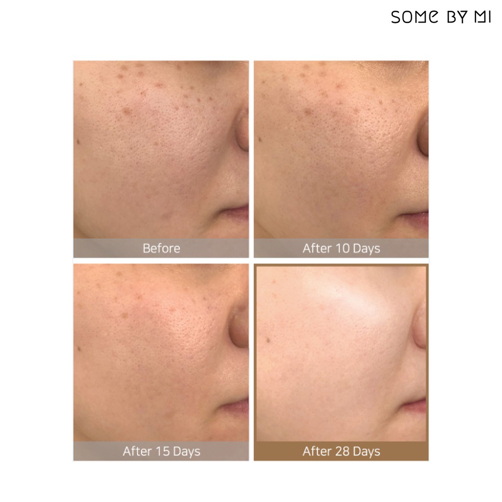[FMCG12-12% ĐH399K]Combo Toner + Serum Some By Mi Dưỡng Trắng , Chống Lão Hóa Vitamin C Galactomyces Pure Vitamin C Glow | BigBuy360 - bigbuy360.vn