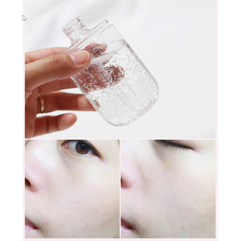 [MUA 1 TẶNG 3] Nước Hoa Hồng Cho Da Mụn Kiêm Xịt Khoáng FORENCOS PH 5.5 Cosmeceutical Toner Mist | BigBuy360 - bigbuy360.vn